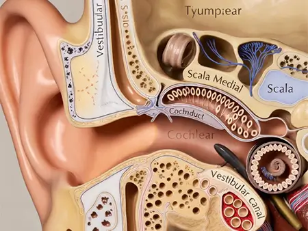 Location of Tinnitus