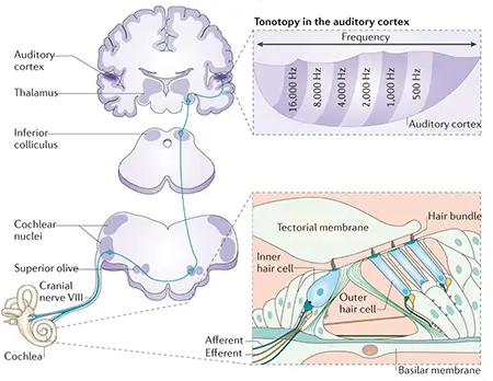 Diagram showing the inner ear and Tinnitus points